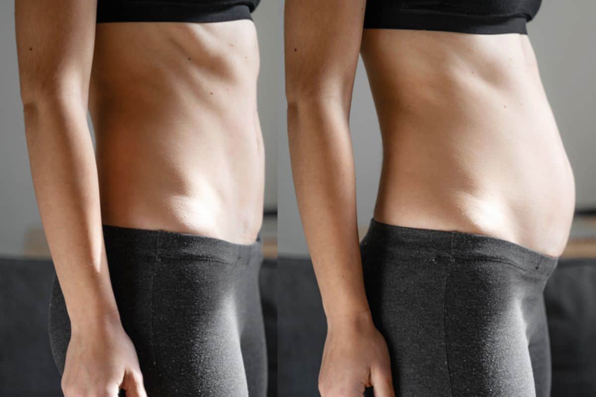 How long does diastasis recti take to improve Hounslow West?