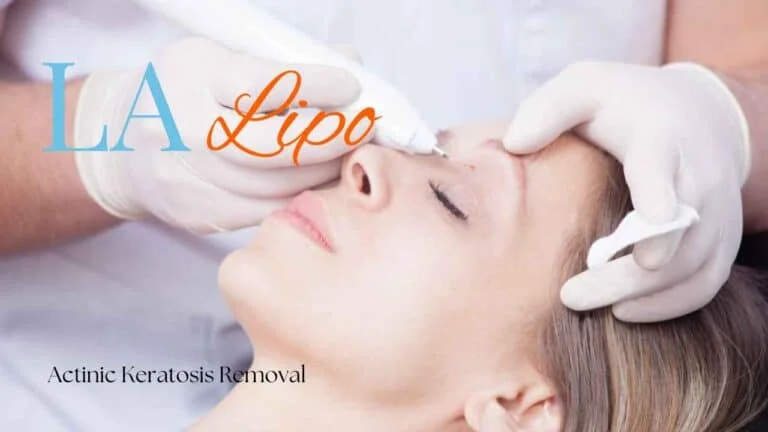 Woman receiving Actinic Keratosis Removal Treatment Hounslow West