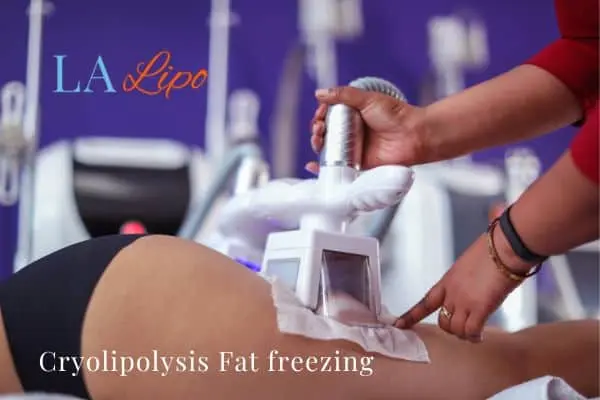 women getting fat freezing Hounslow West