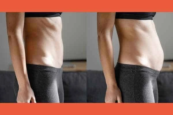 LA-EMS Body Sculpting results Hounslow West