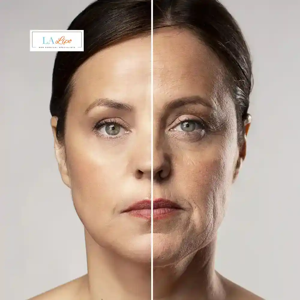 How Can You Tell If Non-Surgical Skin Tightening Is Right for You Hounslow West?