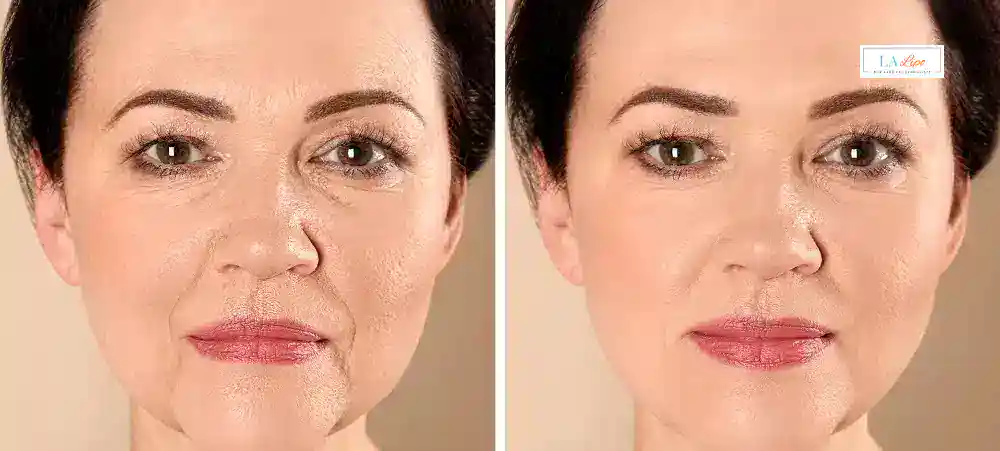 Why Aren’t My Skincare Products Making My Sagging Skin Look Firmer Hounslow West?
