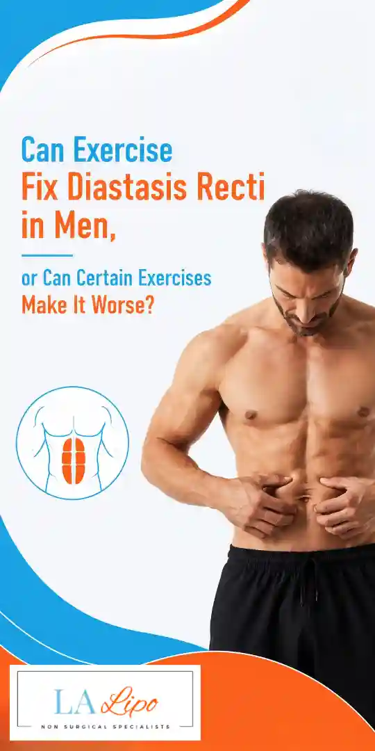 Can Exercise Fix Diastasis Recti in Men, or Can Certain Exercises Make It Worse Hounslow West?